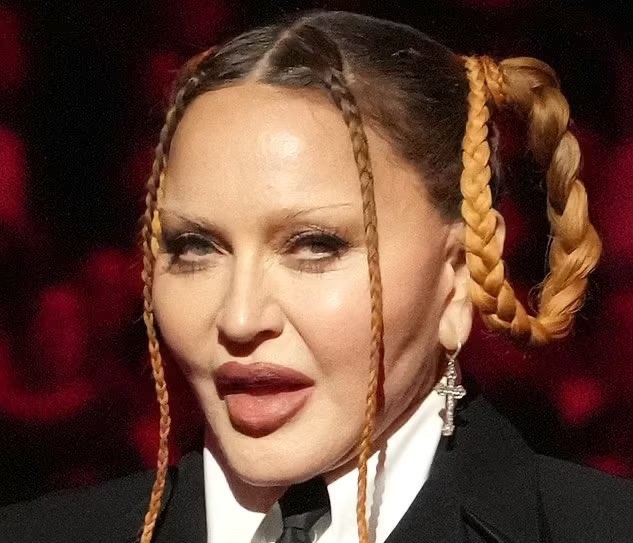 Grammys 2023- Madonna chirurgie ?